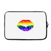 lips  rainbow lgbt gay culture Laptop cover