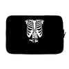 beer belly xray skeleton funny Laptop sleeve