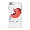 stomach cancer awareness iPhone 7 Case