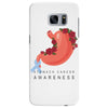 stomach cancer awareness Samsung Galaxy S7 Edge Case