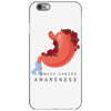 stomach cancer awareness iPhone 6/6s Case
