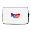 us hot dog Laptop sleeve