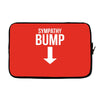 sympathy bump novelty beer belly Laptop sleeve
