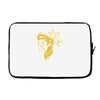 mercy (2) Laptop sleeve