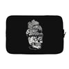 six on the brain Laptop sleeve