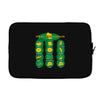 cheesy talk Laptop sleeve