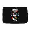 Christmas Skeleton mom and baby maternity Laptop sleeve