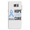 hope love cure stomach cancer awareness Samsung Galaxy S7 Case