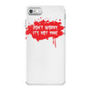 don't worry it's not mine iPhone 7 Case