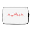 Cycle Laptop sleeve