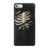 torn rib cage iPhone 7 Case