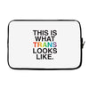 This Is What Trans Looks Like Laptop sleeve