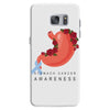 stomach cancer awareness Samsung Galaxy S7 Case