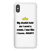 dentist crown iPhoneX