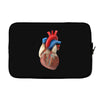 realistic human heart Laptop sleeve