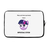 twilight has special eyes Laptop sleeve