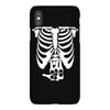 beer belly xray skeleton funny iPhoneX
