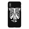 beer belly xray skeleton funny iPhoneX