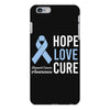 hope love cure stomach cancer awareness iPhone 6 Plus/6s Plus Case