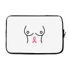 breast with pink ribbon Laptop sleeve