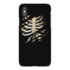 torn rib cage iPhoneX Case