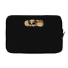 i'm a potato Laptop sleeve