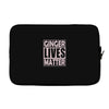 ginger lives matte Laptop sleeve