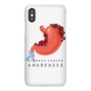 stomach cancer awareness iPhoneX Case